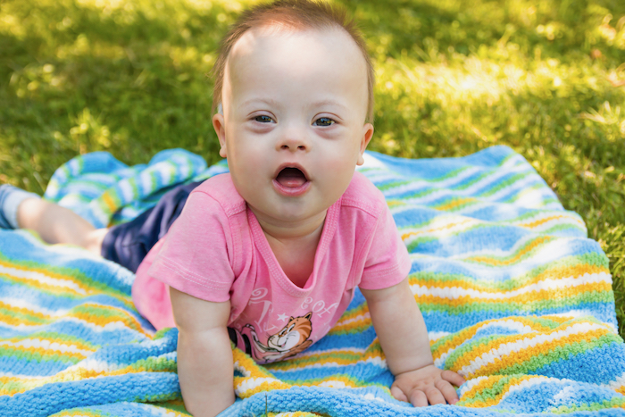 Baby boy with Down Syndrome is lying on a blanket on nature